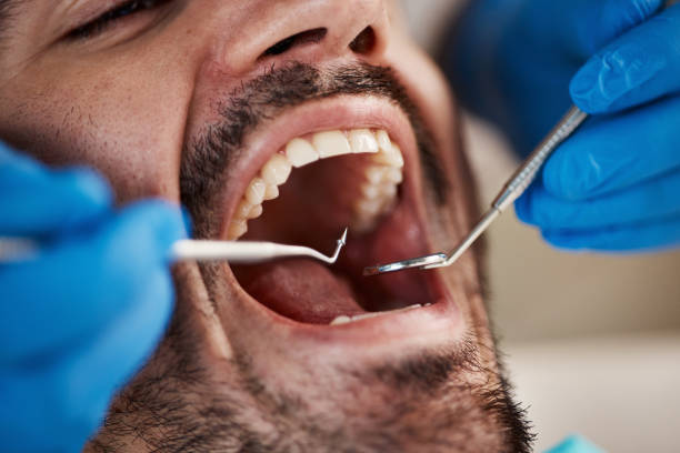 Best Emergency Treatment for Toothache in Gautier, MS