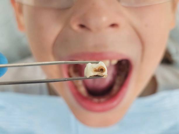 Best Pediatric Emergency Dentist in Gautier, MS